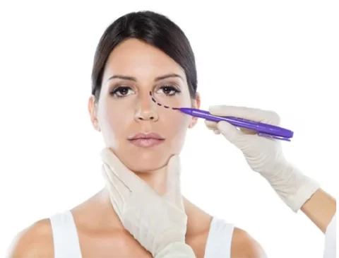 BLEFAROPLASTIA-2-480x365