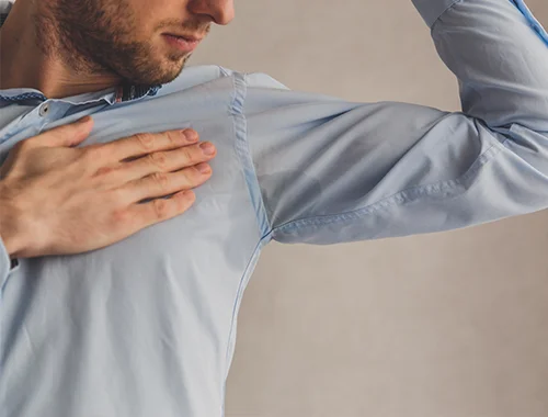 hiperhidrosis-3